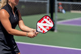 ONIX Z3 Composite Pickleball Paddle lifestyle